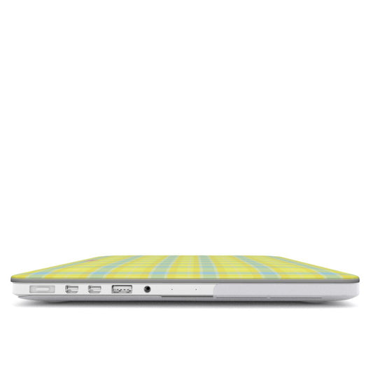 Butter Cloud MacBook Case