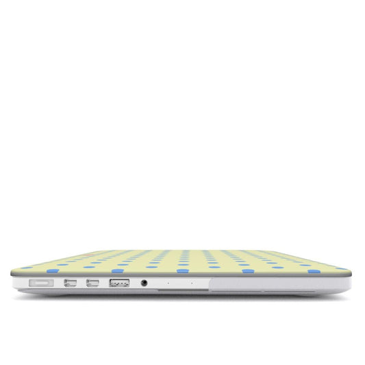Vanilla Sky MacBook Case - SmartHomeGoodies