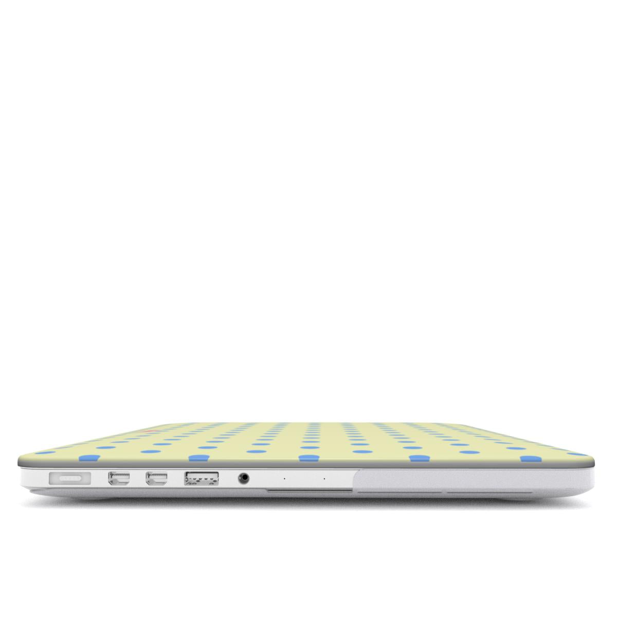 Vanilla Sky MacBook Case