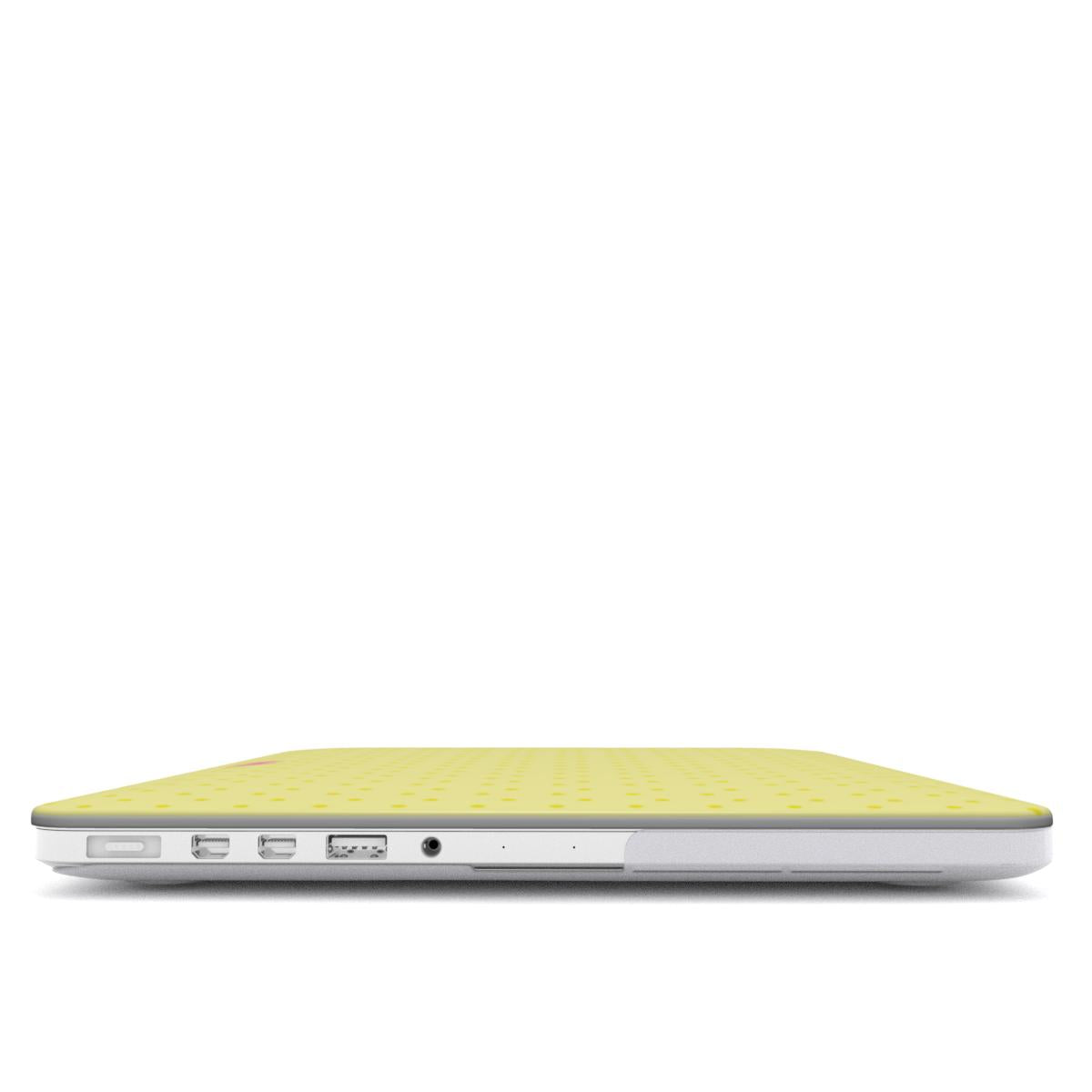Buttercream MacBook Case