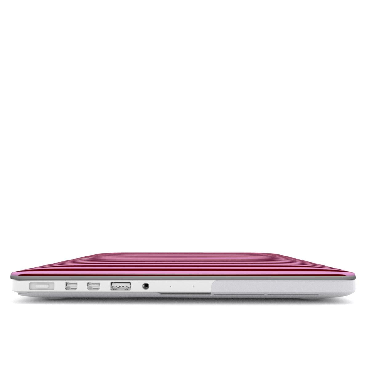 Cherry Bonbon MacBook Case