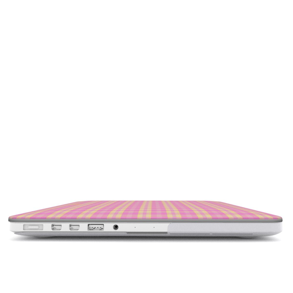SugarPlum MacBook Case