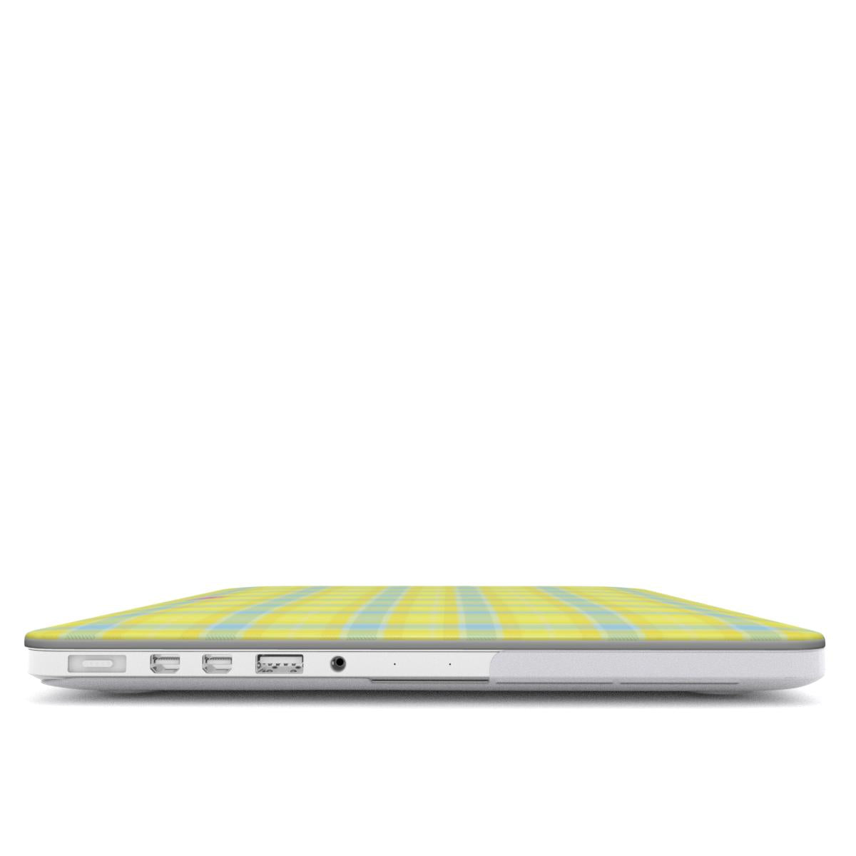 Butter Cloud MacBook Case