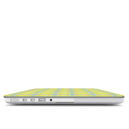 Butter Cloud MacBook Case