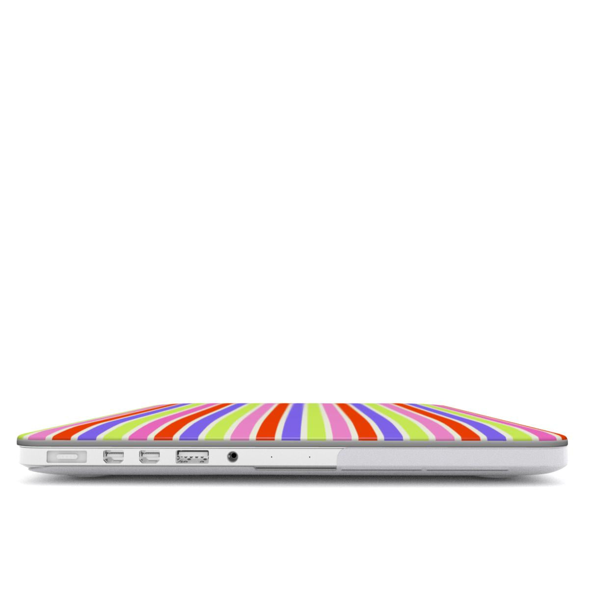 Tropicolor MacBook Case