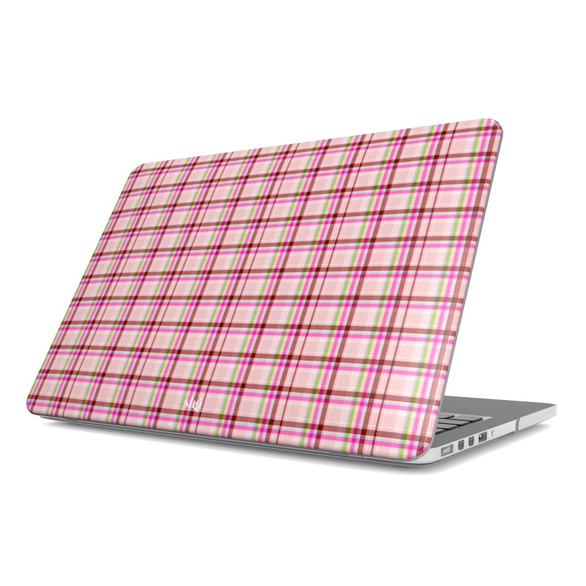 Sunday Girl MacBook Case
