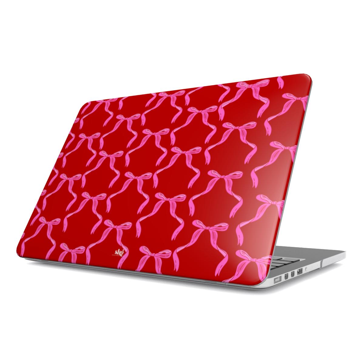 The Coquette It Girl MacBook Case