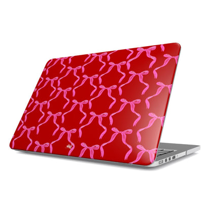 The Coquette It Girl MacBook Case