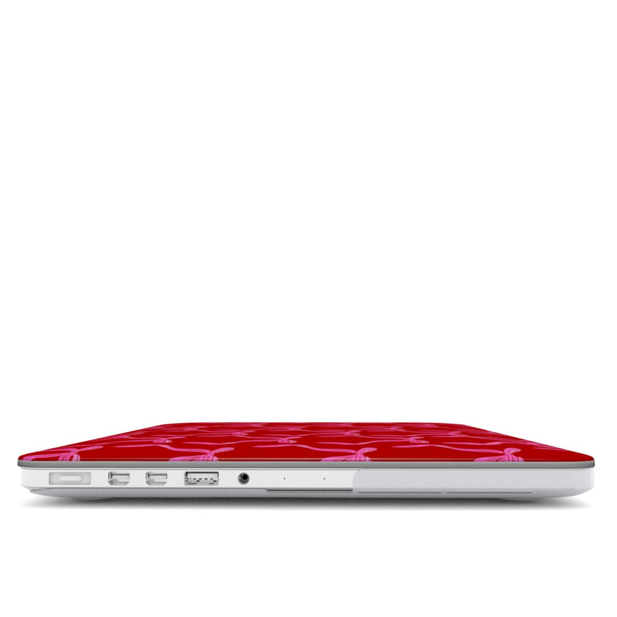 The Coquette It Girl MacBook Case