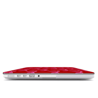The Coquette It Girl MacBook Case