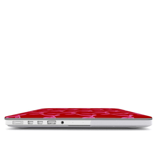 The Coquette It Girl MacBook Case