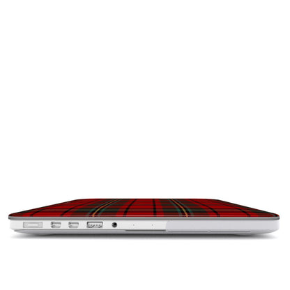 Miss December MacBook Case