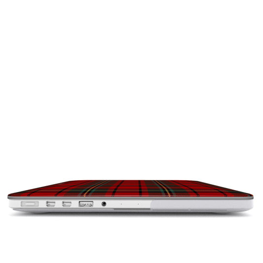 Miss December MacBook Case