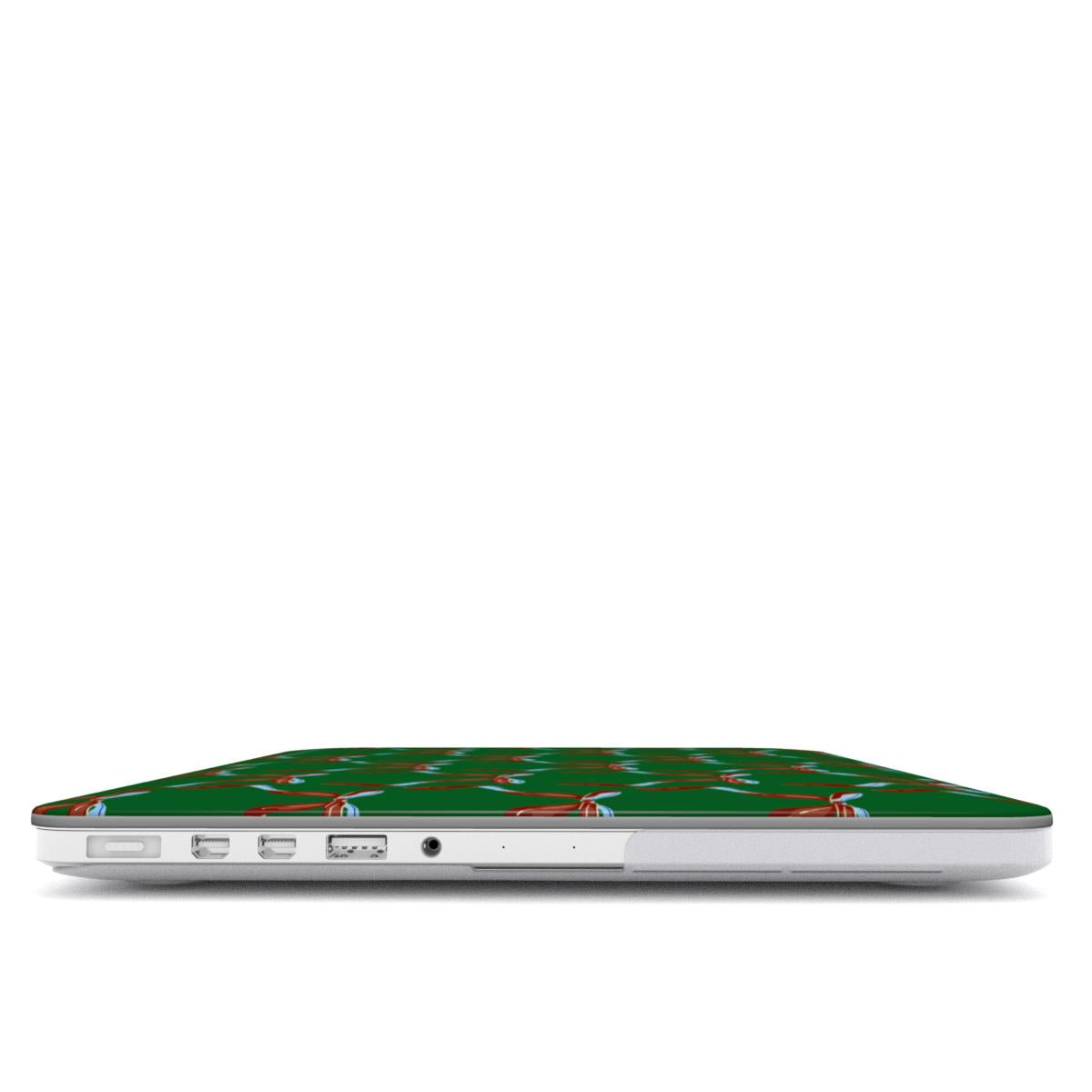 The Bow It Girl MacBook Case