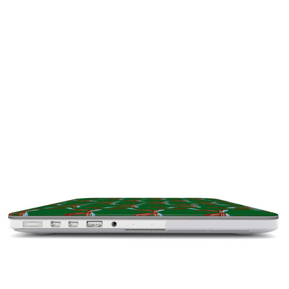 The Bow It Girl MacBook Case
