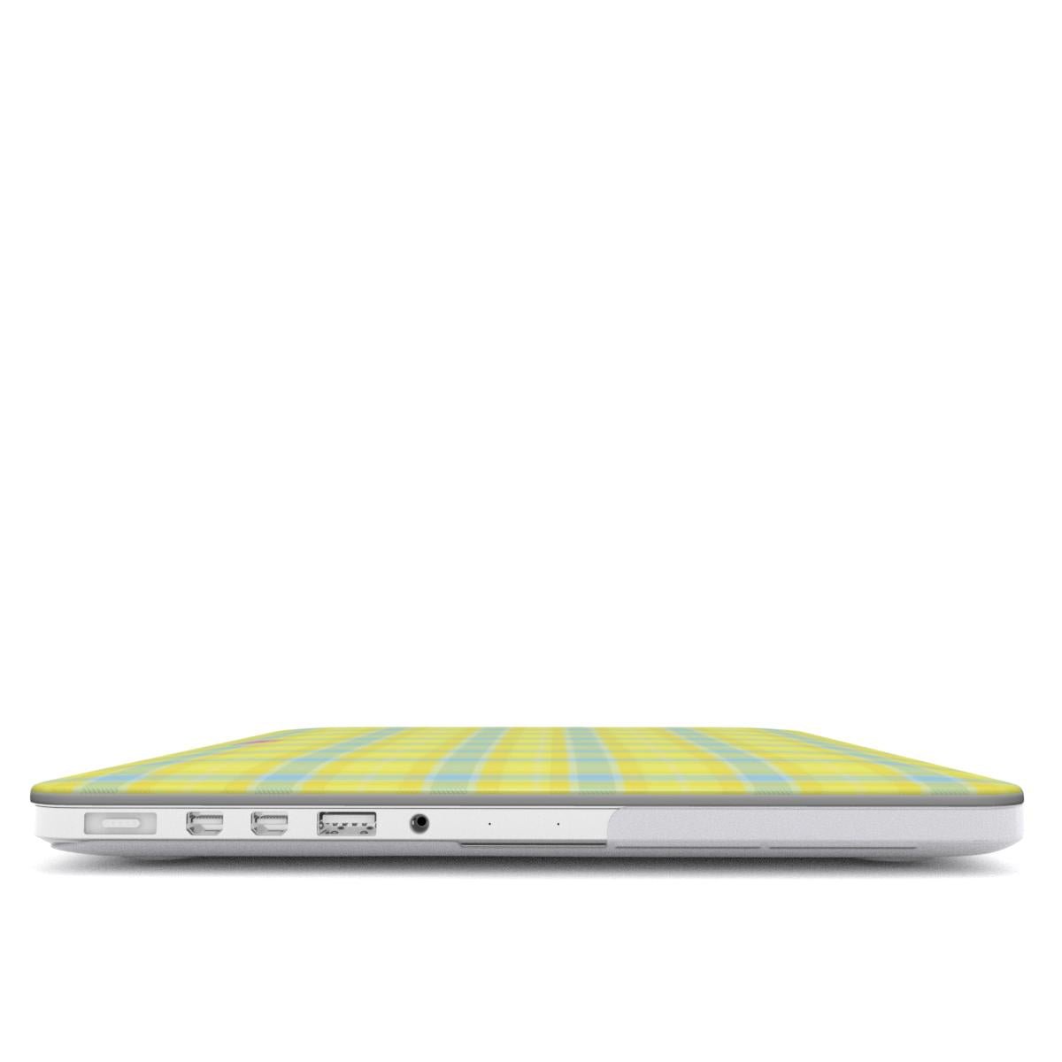 Butter Cloud MacBook Case - SmartHomeGoodies