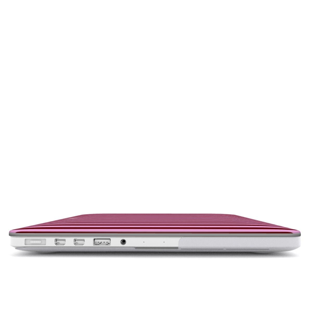 Cherry Bonbon MacBook Case - SmartHomeGoodies
