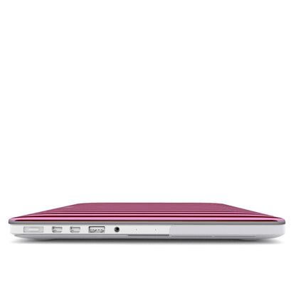 Cherry Bonbon MacBook Case - SmartHomeGoodies