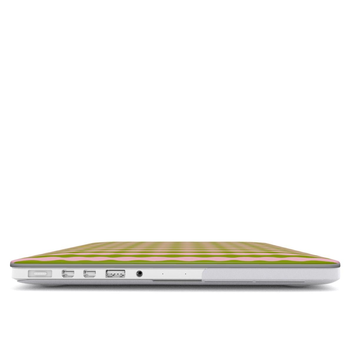 Dolce Summer MacBook Case - SmartHomeGoodies