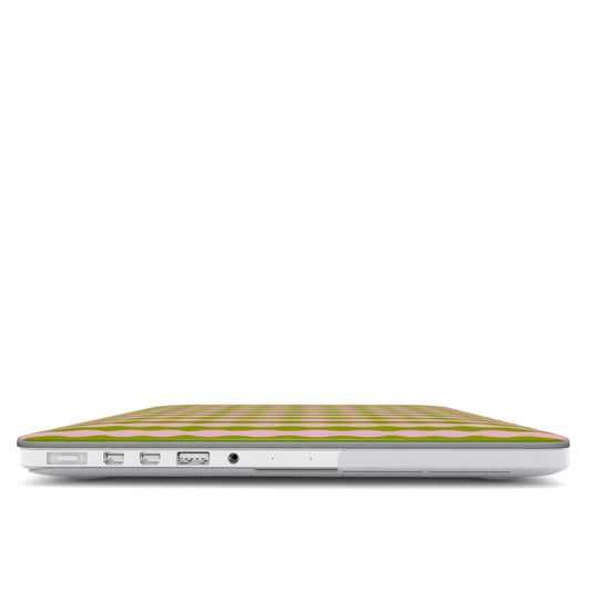 Dolce Summer MacBook Case - SmartHomeGoodies