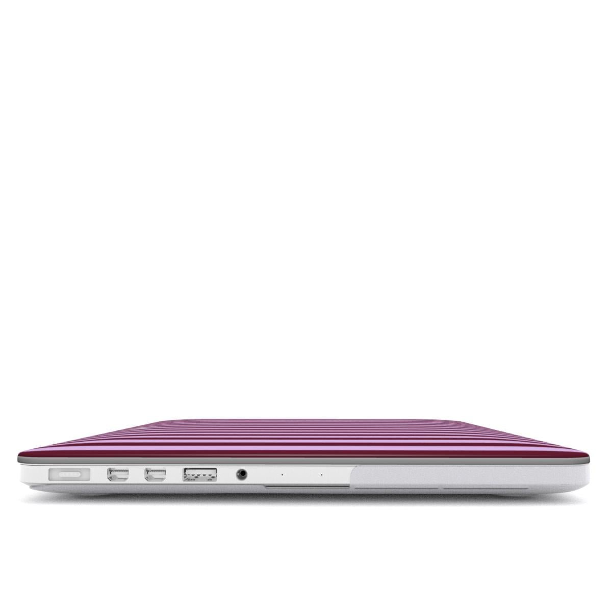 Plum Pie MacBook Case - SmartHomeGoodies