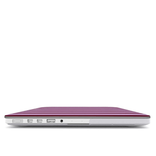 Plum Pie MacBook Case - SmartHomeGoodies