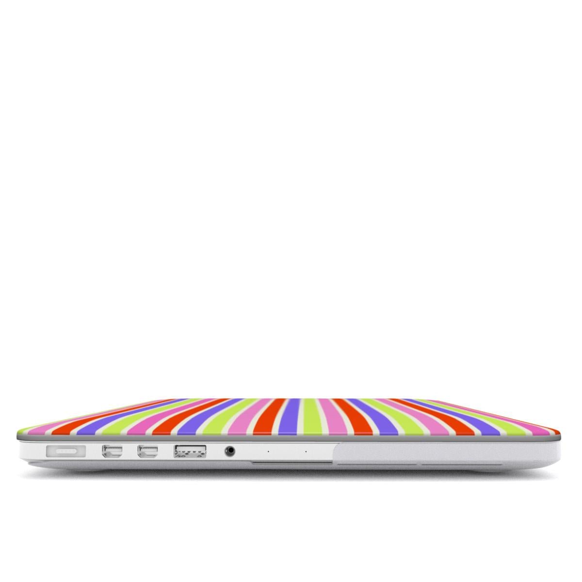 Tropicolor MacBook Case - SmartHomeGoodies