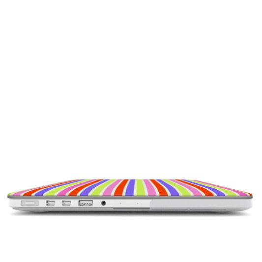Tropicolor MacBook Case - SmartHomeGoodies