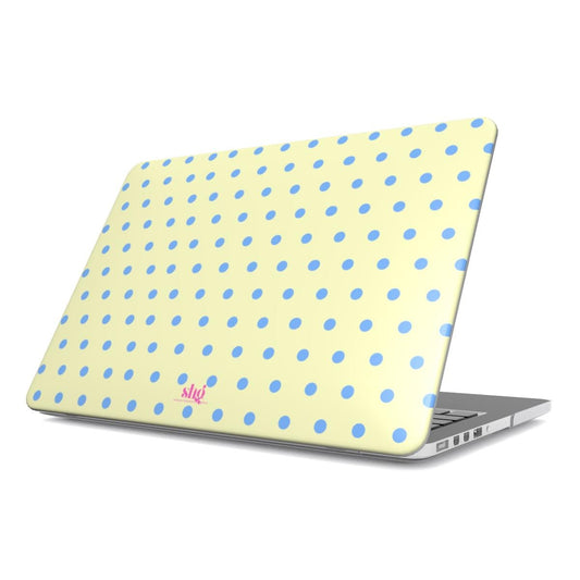 Vanilla Sky MacBook Case - SmartHomeGoodies