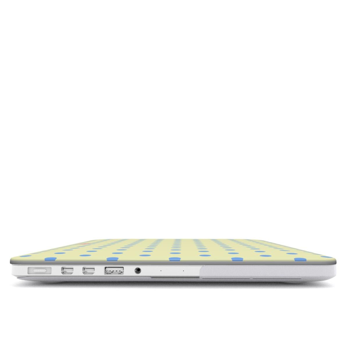 Vanilla Sky MacBook Case - SmartHomeGoodies