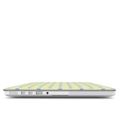 Vanilla Sky MacBook Case - SmartHomeGoodies