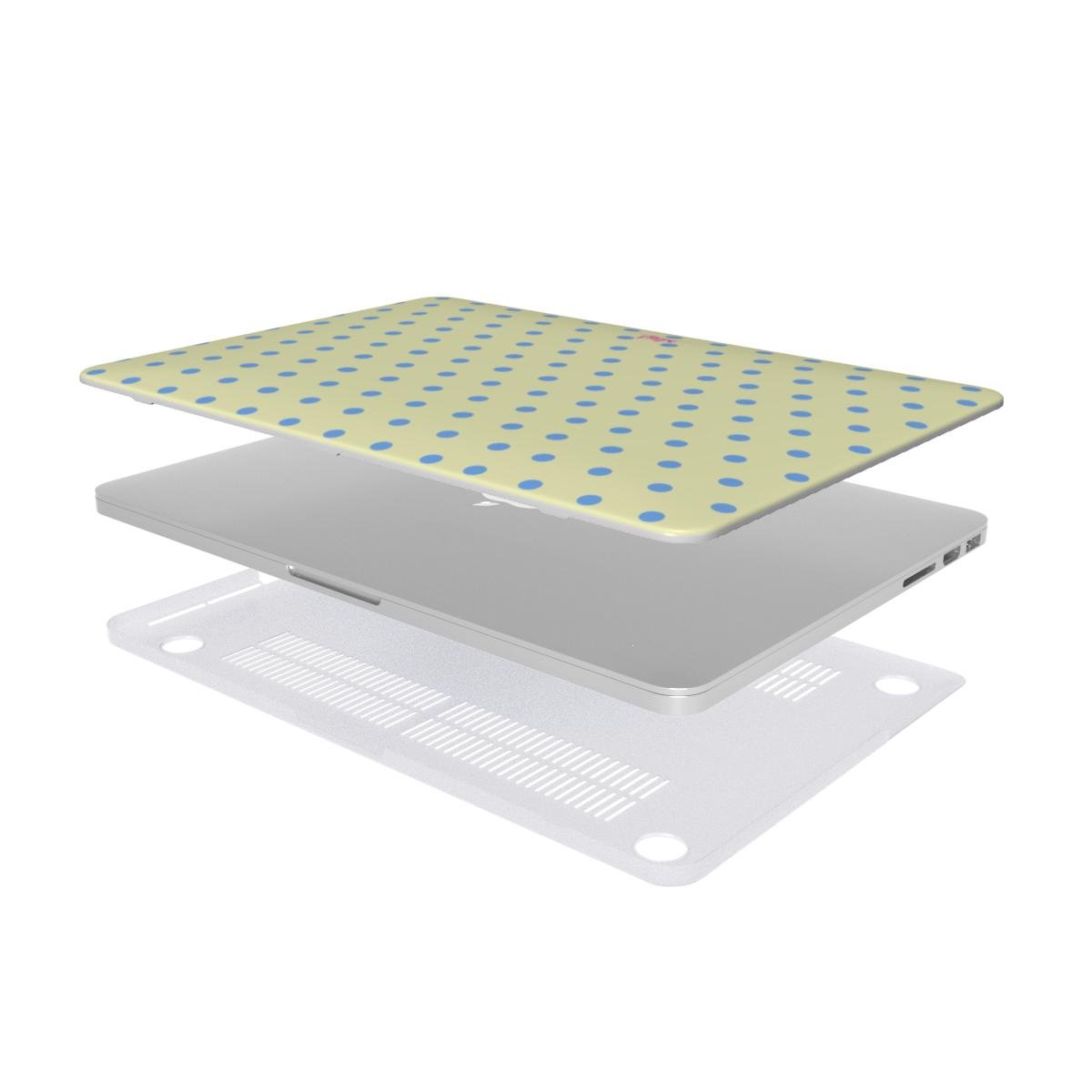 Vanilla Sky MacBook Case - SmartHomeGoodies