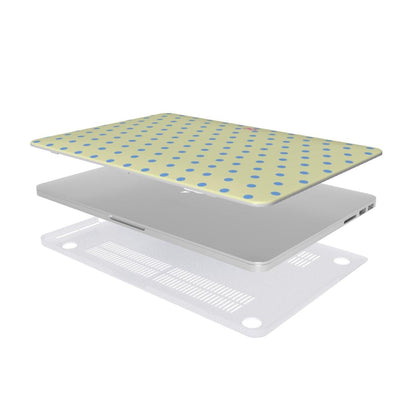 Vanilla Sky MacBook Case - SmartHomeGoodies